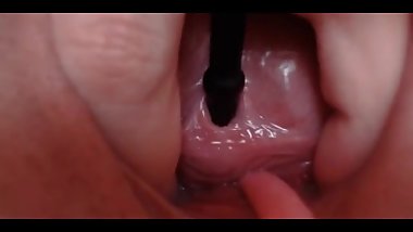 pee hol object insertion